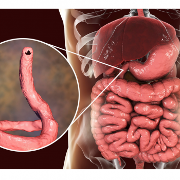 Ancylostomosis Ancylostomosis