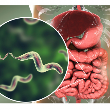 Campylobacteriosis