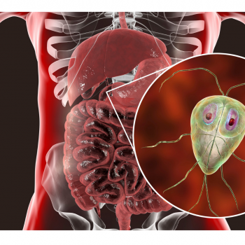 Giardiasis Giardiasis